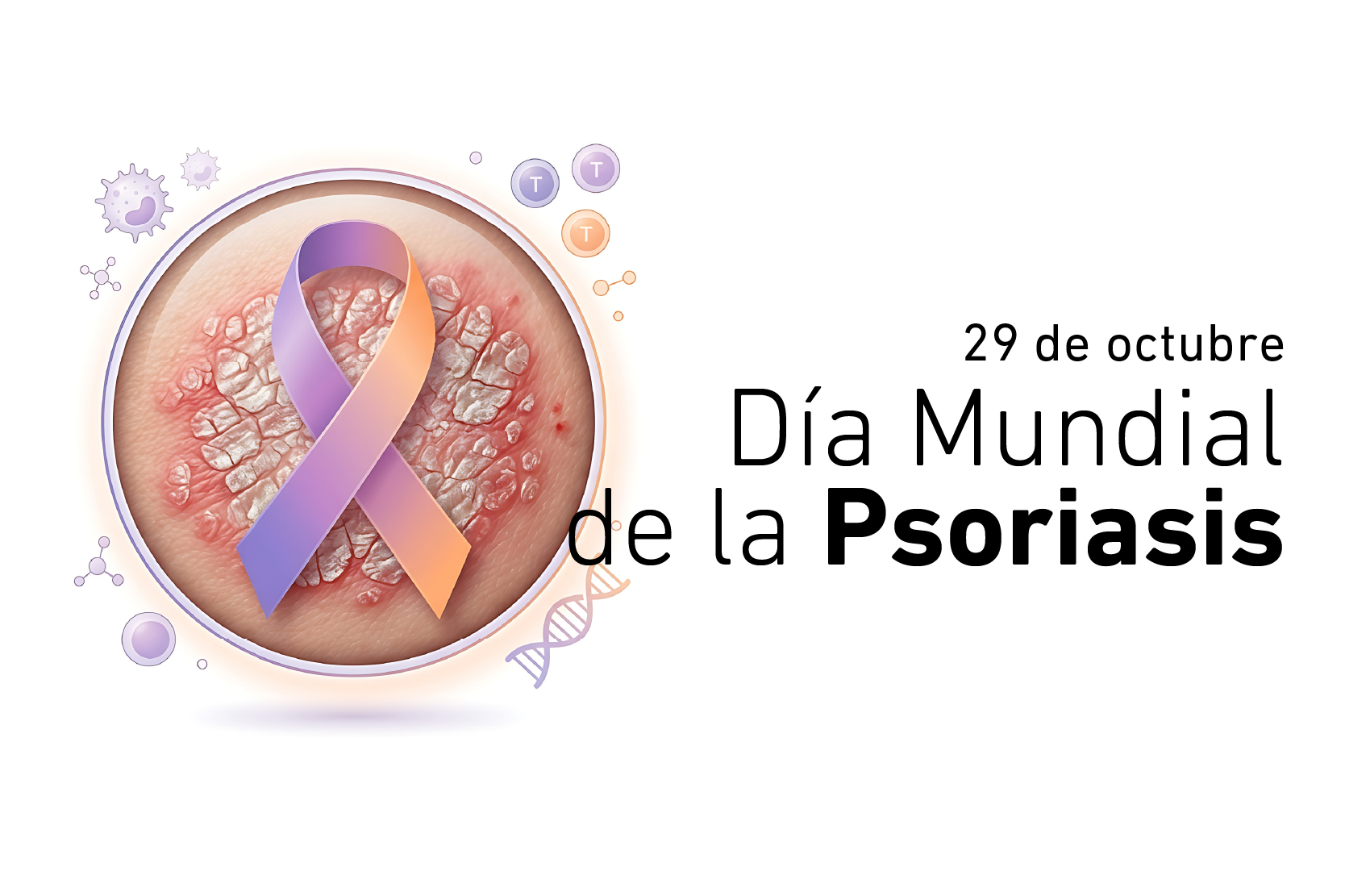 29 de octubre: Día Mundial de la Psoriasis